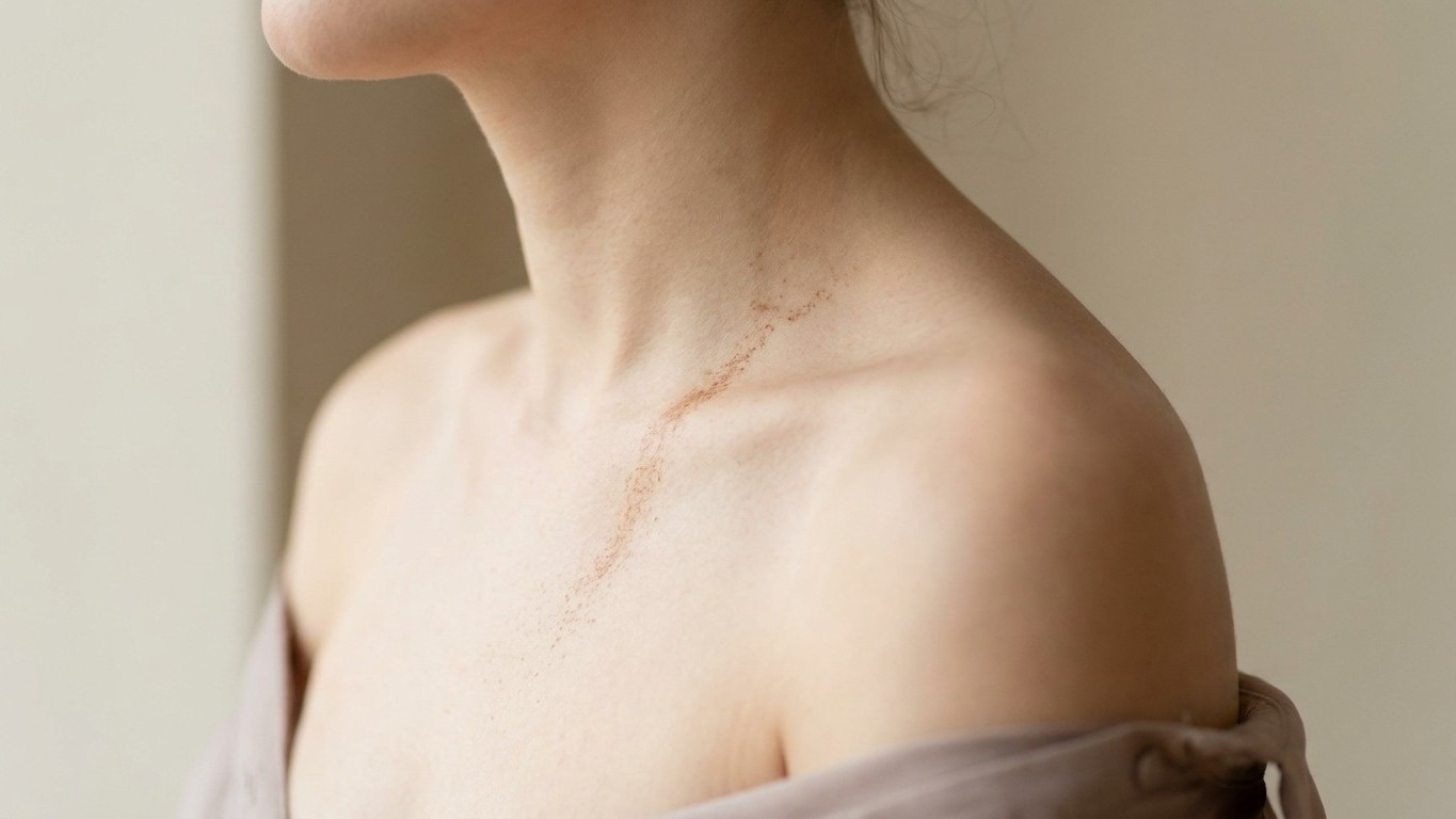 Je vaporisais mon parfum sur le cou avant d'aller bronzer : quand j'ai vu ce qui apparaissait sur ma peau, il était trop tard